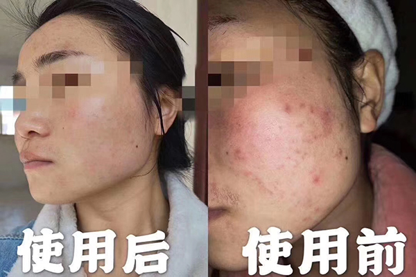 精油能喝嗎？不是所有精油都能喝-歐泉生化